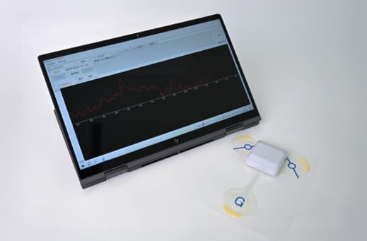 腸電位計の写真