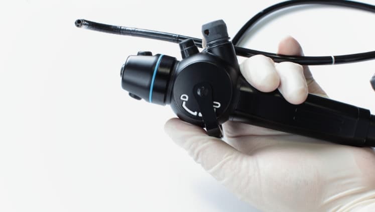 内視鏡・カテーテル検査のイメージ写真